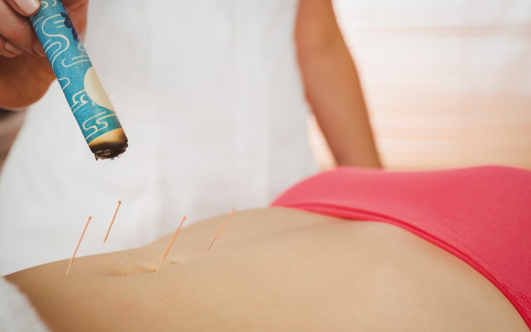 Learn How Acupuncture Classes Dallas Can Prepare You for a Rewarding Holistic Career Path